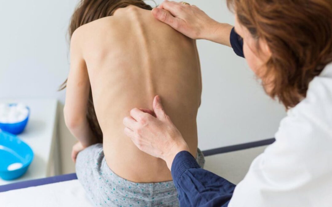 “Escoliosis del adolescente” por Lic. Silvana Suárez