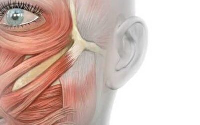 Parálisis facial por Lic. Iván Ahumada