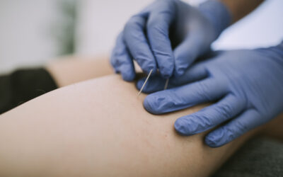 Fisioterapia invasiva y electrólisis percutánea electro dirigida por Klgo. Fernando Polidori