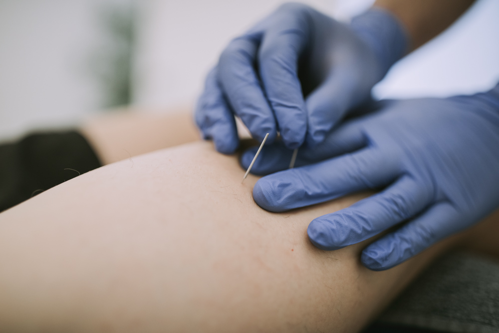 Fisioterapia invasiva y electrólisis percutánea electro dirigida por Klgo. Fernando Polidori